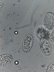 Scutellinia olivascens