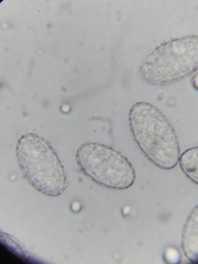 Scutellinia olivascens