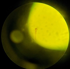 Puccinia digitata