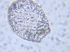 Euglypha
