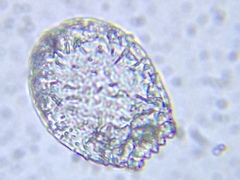 Euglypha