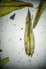 Schistidium frigidum