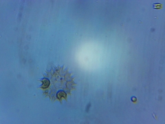 Pseudopediastrum boryanum longicorne