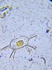 Xanthidium antilopaeum