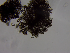 Dolichospermum lemmermannii