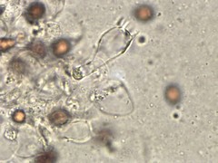 Coprinopsis depressiceps