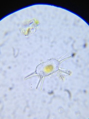 Xanthidium antilopaeum