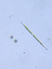 Gonatozygon brebissonii