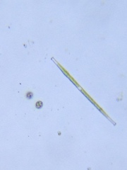 Gonatozygon brebissonii