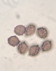Anthoceros agrestis