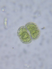 Cosmarium contractum