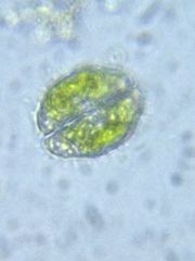 Cosmarium pseudotaxichondrum