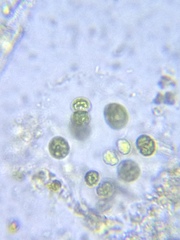 Sphaerocystis