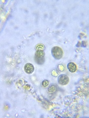 Sphaerocystis