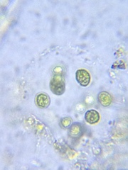 Sphaerocystis