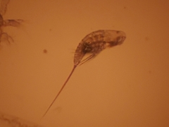 Microsetella norvegica