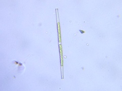 Gonatozygon brebissonii