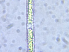 Gonatozygon brebissonii