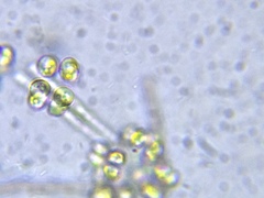 Ophiocytium