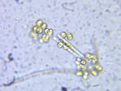 Ophiocytium
