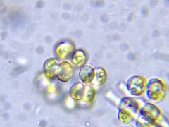 Ophiocytium