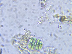 Gomphosphaeria