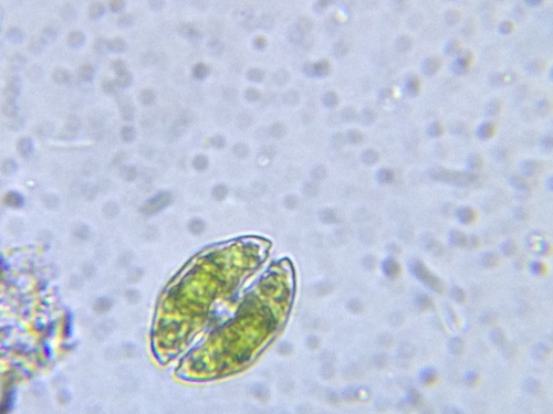 Cosmarium pseudotaxichondrum