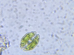 Cosmarium pseudotaxichondrum