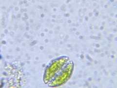 Cosmarium pseudotaxichondrum