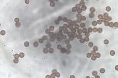 Physarum leucophaeum