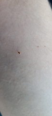 Coleoptera