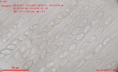 Trichophaea gregaria