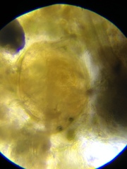 Chydorus