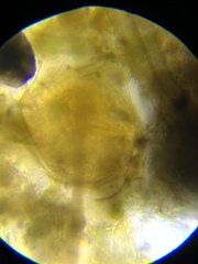 Chydorus