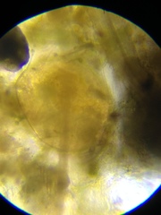 Chydorus