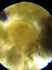 Chydorus