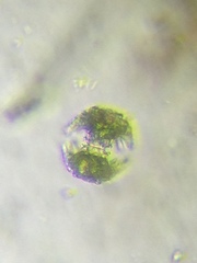 Staurastrum cerastes