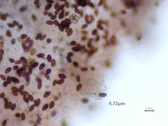 Psathyrella microrhiza