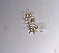 Asterionellopsis glacialis