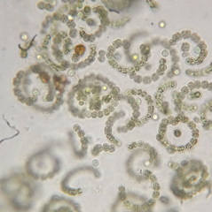 Anabaena circinalis