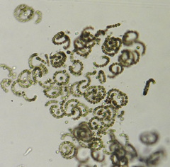 Anabaena circinalis