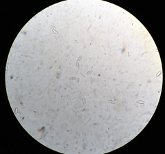 Trichophaea gregaria