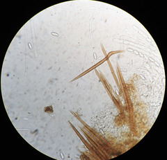 Trichophaea gregaria