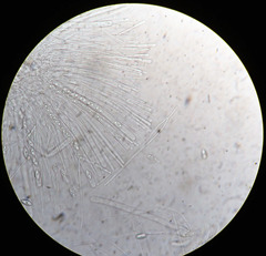 Trichophaea gregaria