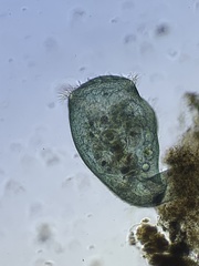 Stentor coeruleus