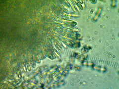 Colletotrichum gloeosporioides