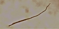 Stigmatopora nigra