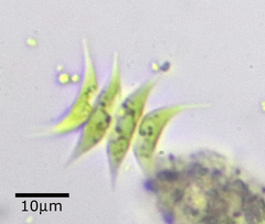 Tetradesmus lagerheimii