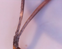 Rhizosphaera kalkhoffii