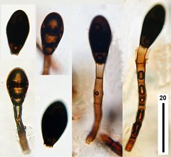 Endophragmiella biseptata